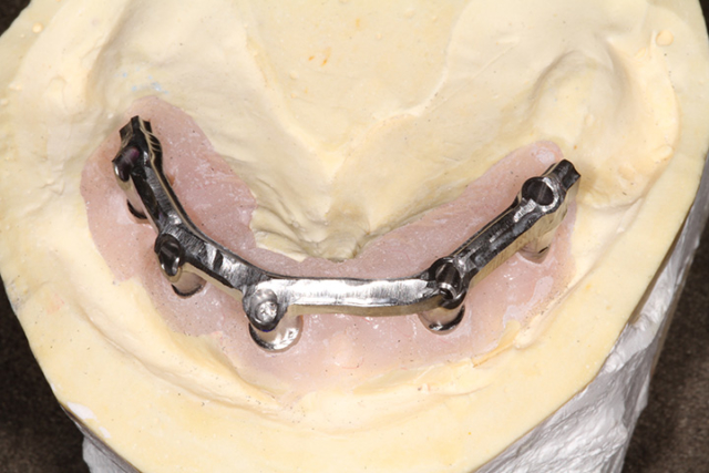 Precision Art Dental Lab