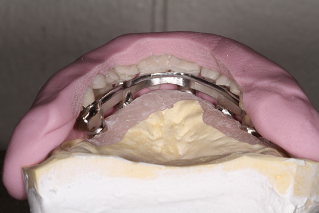 Precision Art Dental Lab