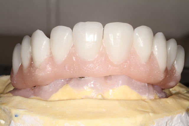 Precision Art Dental Lab