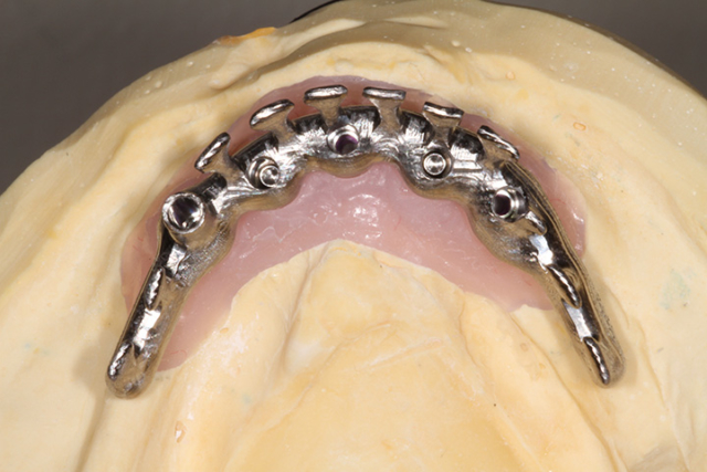 Precision Art Dental Lab