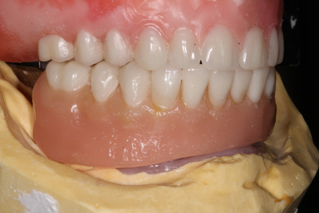 Precision Art Dental Lab