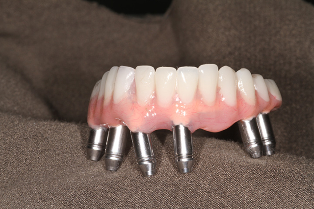 Precision Art Dental Lab